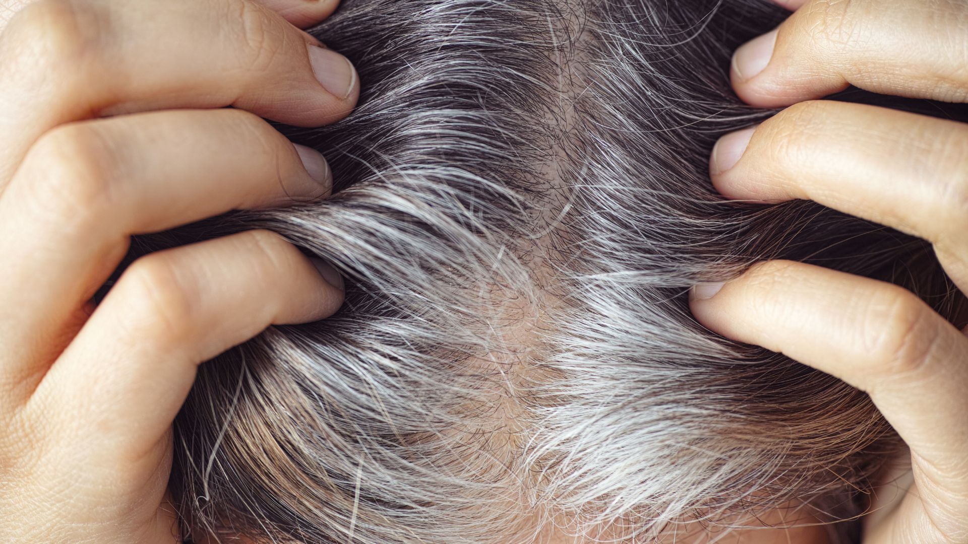 Person with gray hair grabbing their scalp .